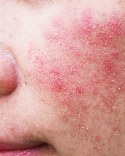 allergy testing center Allergy Solutions near me