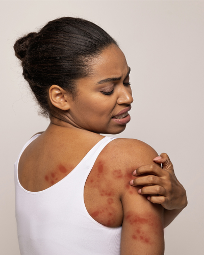 allergy testing clinic allergy testing near me