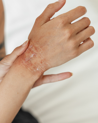 allergy testing near me allergy and asthma specialist