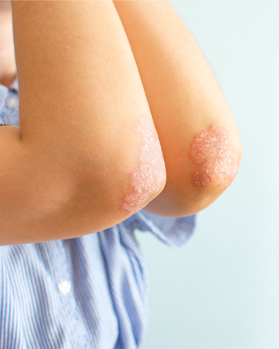 allergy testing allergy testing center