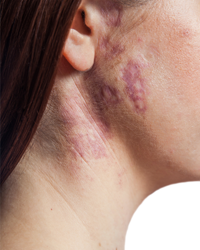 allergy testing center