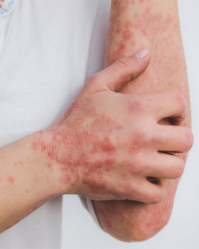 allergy and asthma specialist allergy testing near me