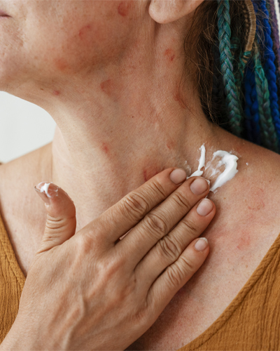 allergy testing center allergy testing clinic