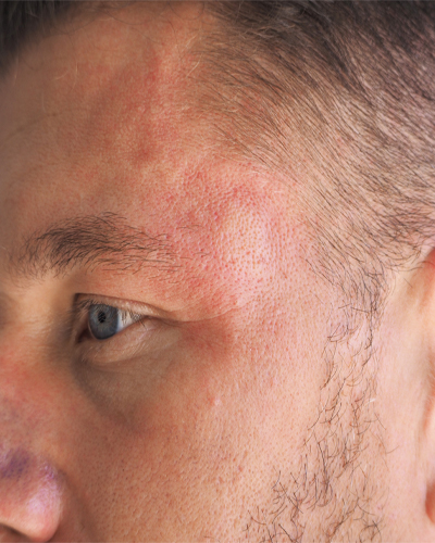 allergy testing center 