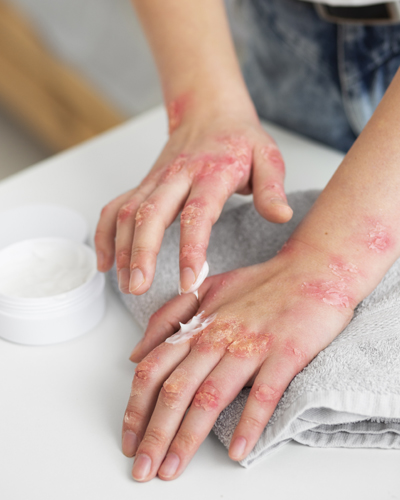 allergy testing clinic allergy testing center