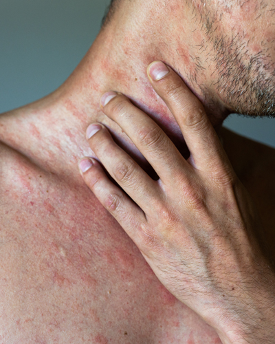 allergy testing clinic allergy testing near me